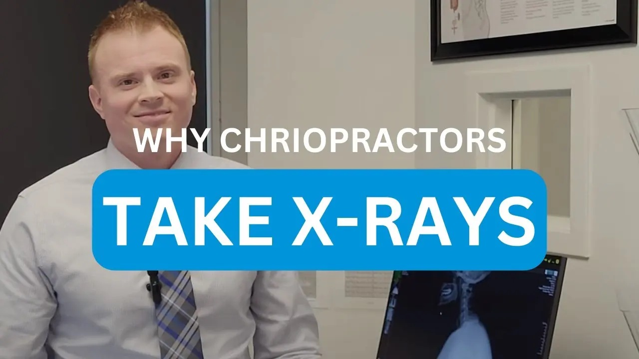 Why Chiropractors Take X-Rays