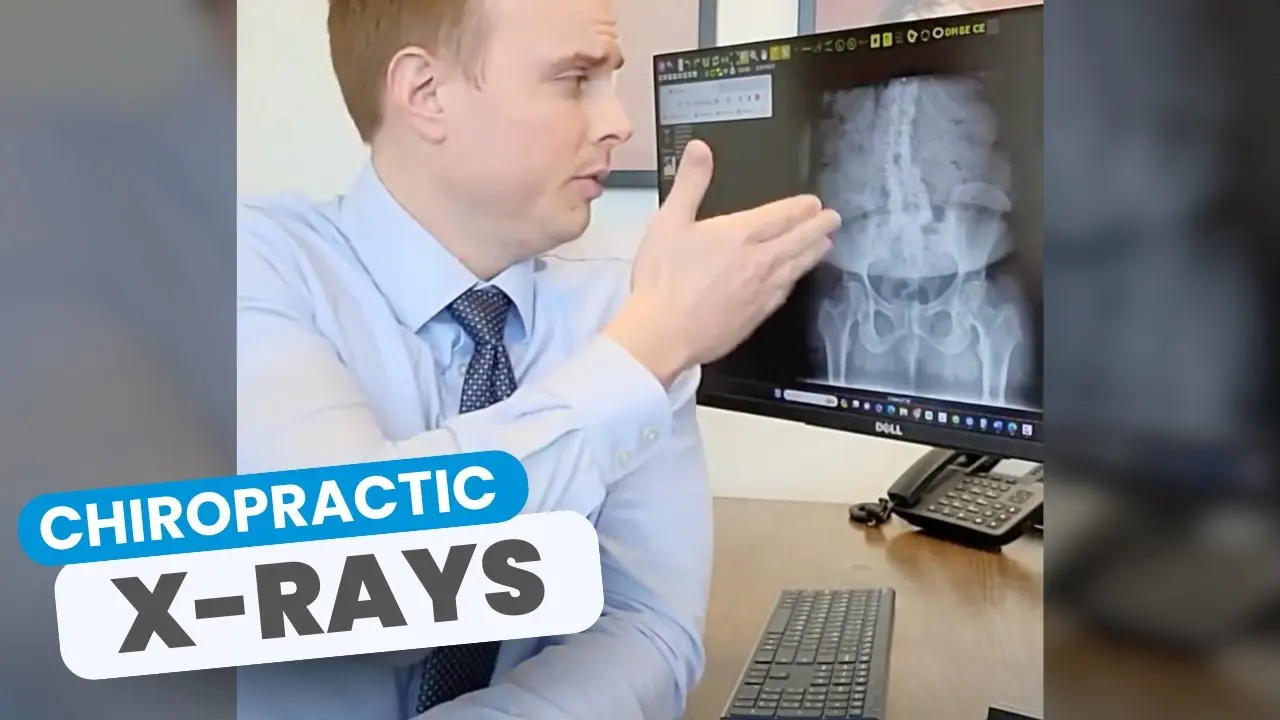 Chiropractic X-rays